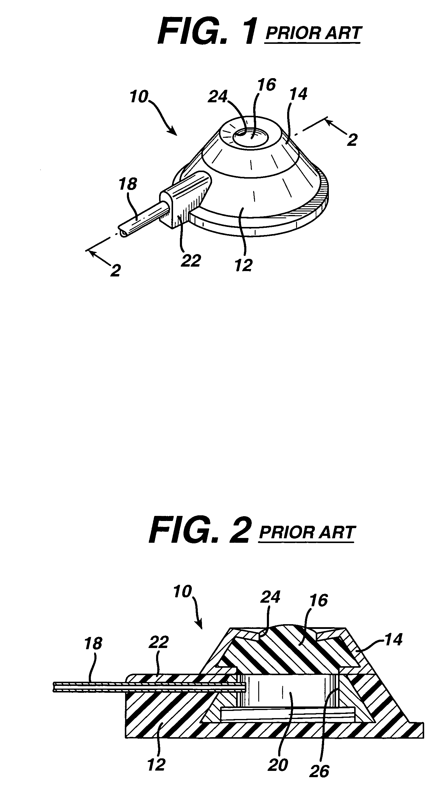 Method for implanting flexible injection port