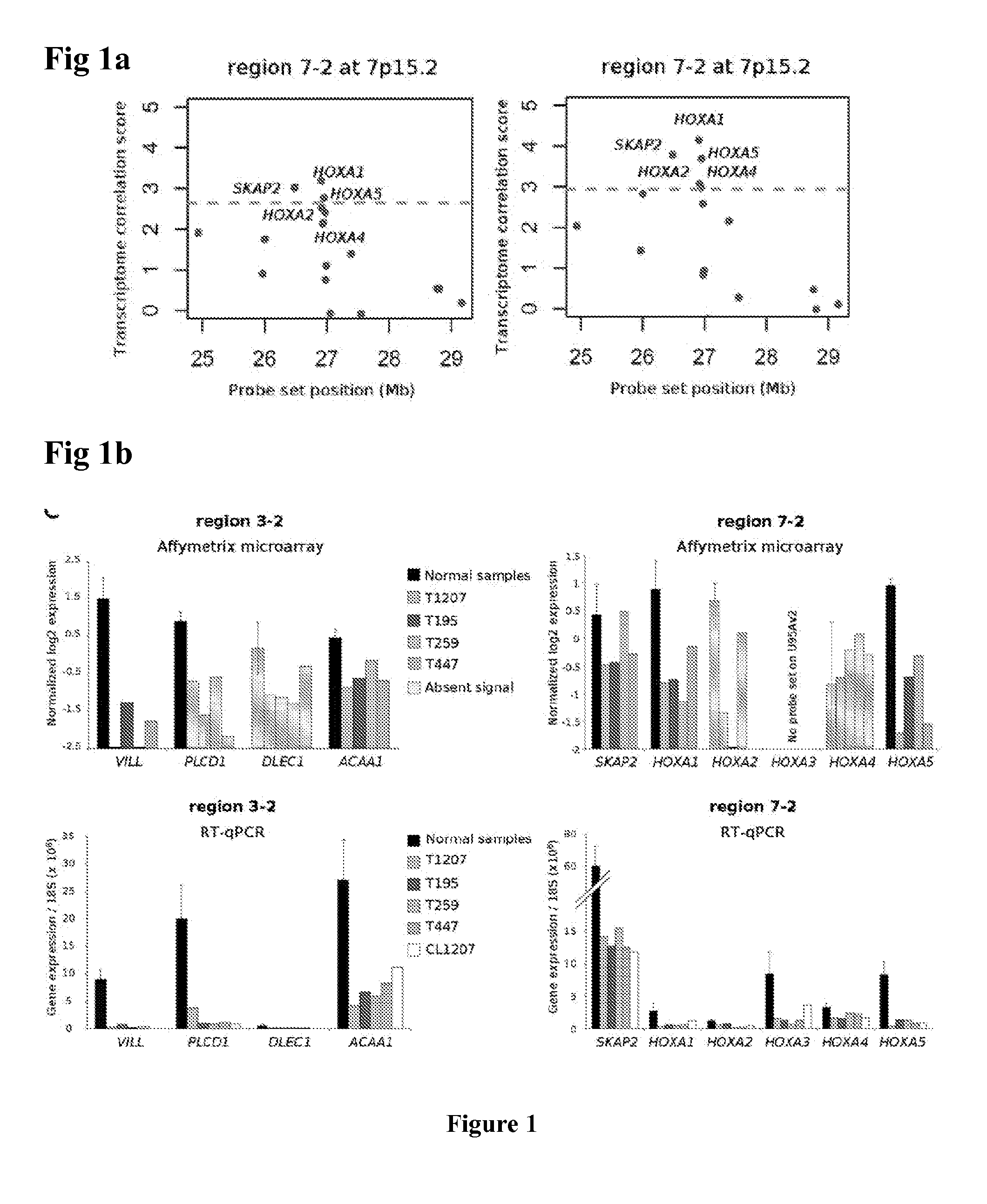Method for predicting the sensitivity of a tumor to an epigenetic treatment