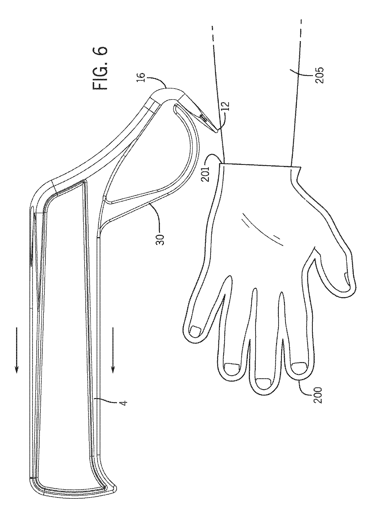 Glove remover apparatus