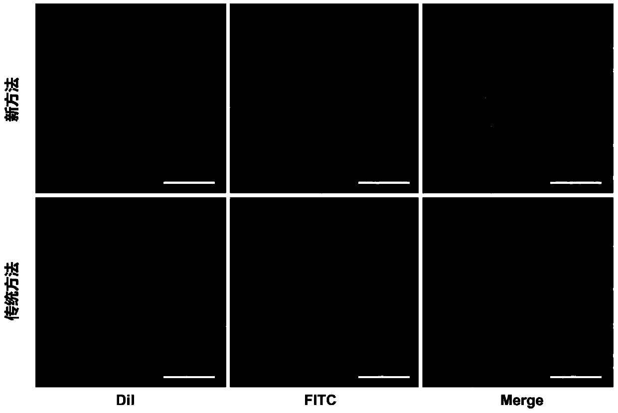 Preparation method of targeted microbubble ultrasound contrast agent modified by single-chain antibody