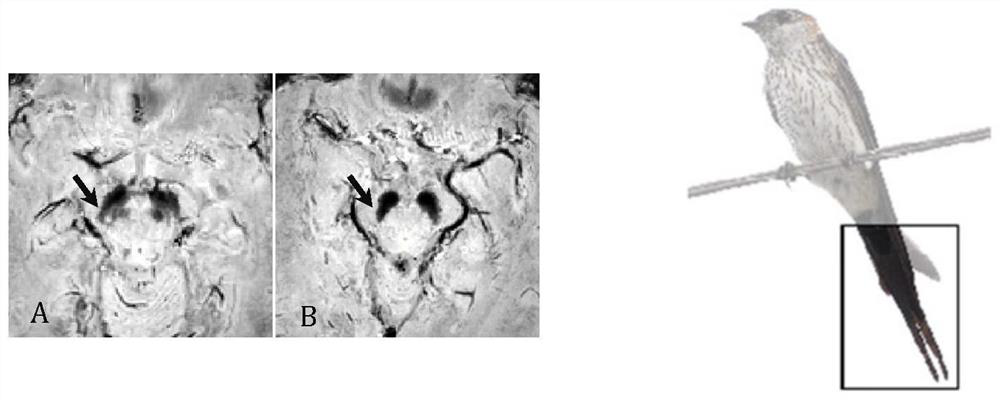 Black plastid-1 sign automatic identification method and system of multi-task neural network based on multi-echo GRE sequence