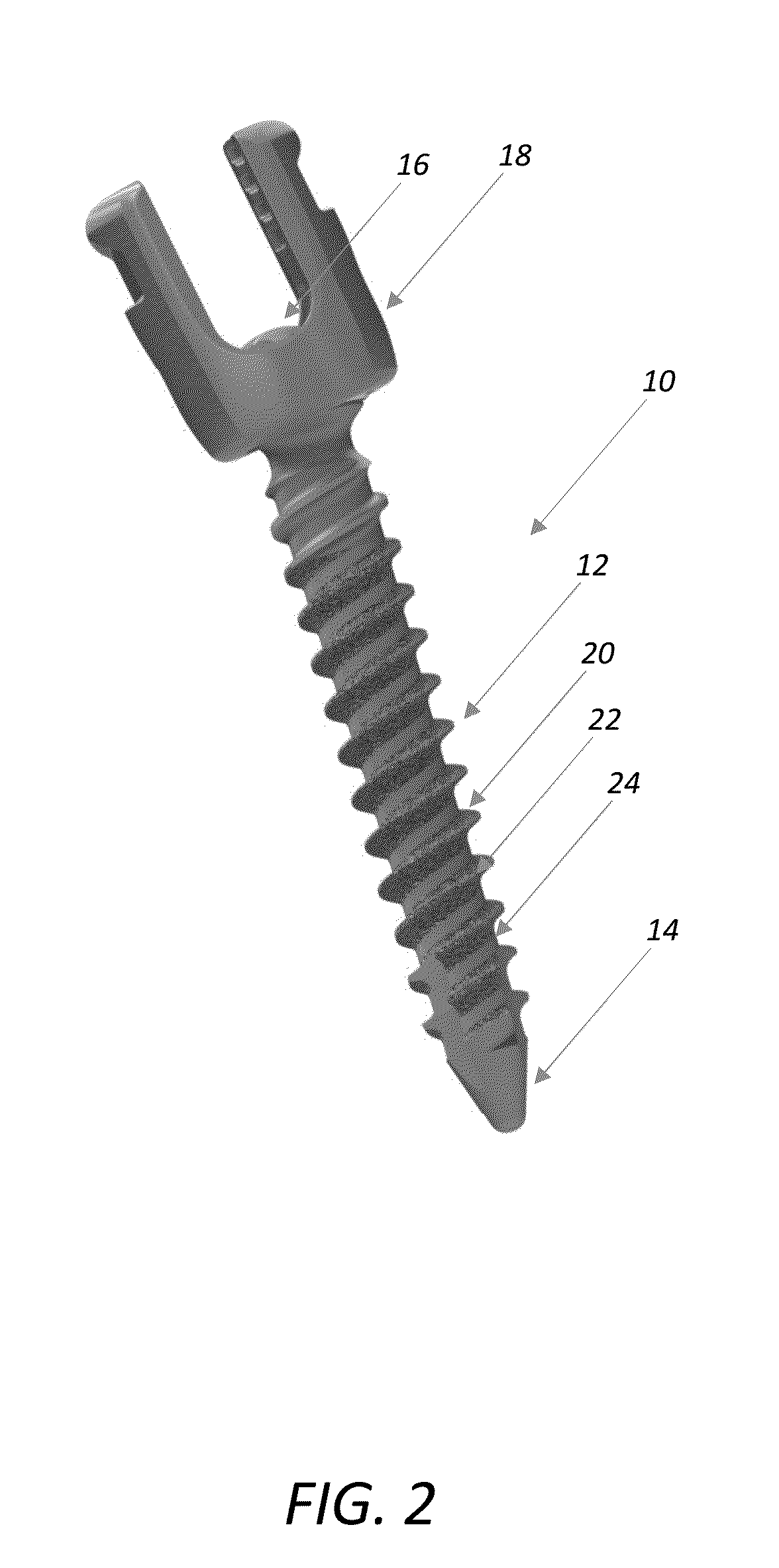 Bone screw incorporating a porous surface formed by an additive manufacturing process