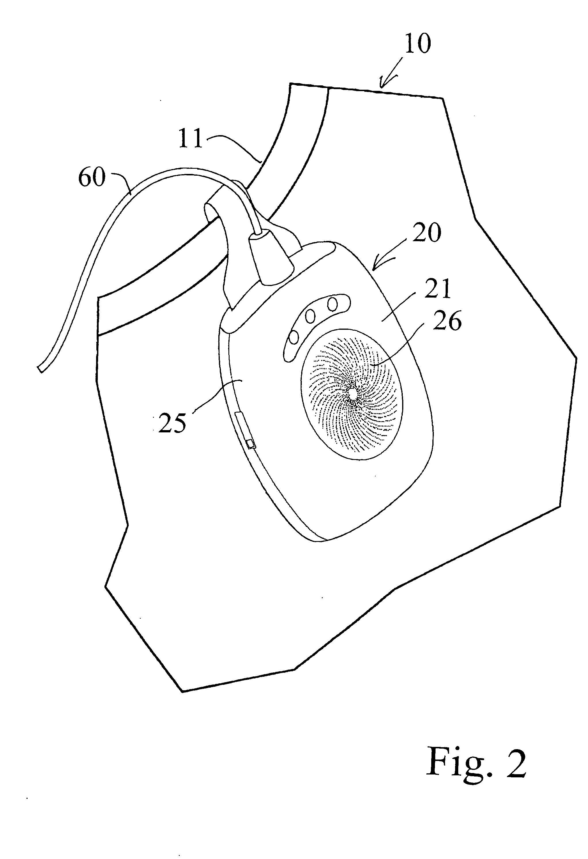 Enuresis device with magnetic fastener