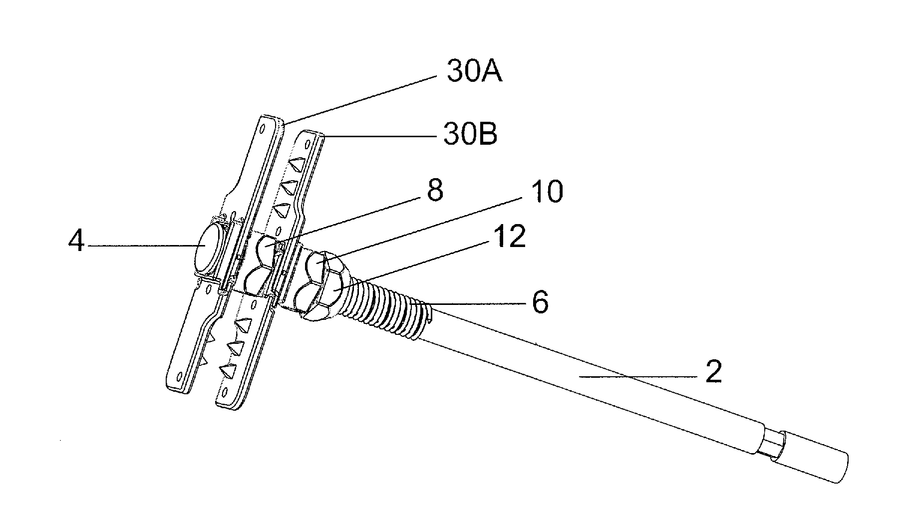 Spinous process fixation plate and minimally invasive method for placement
