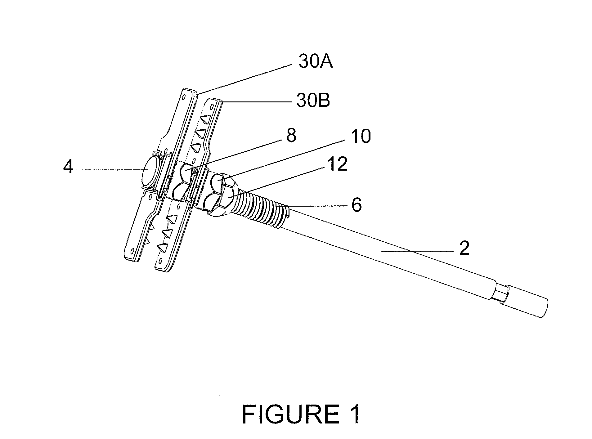 Spinous process fixation plate and minimally invasive method for placement