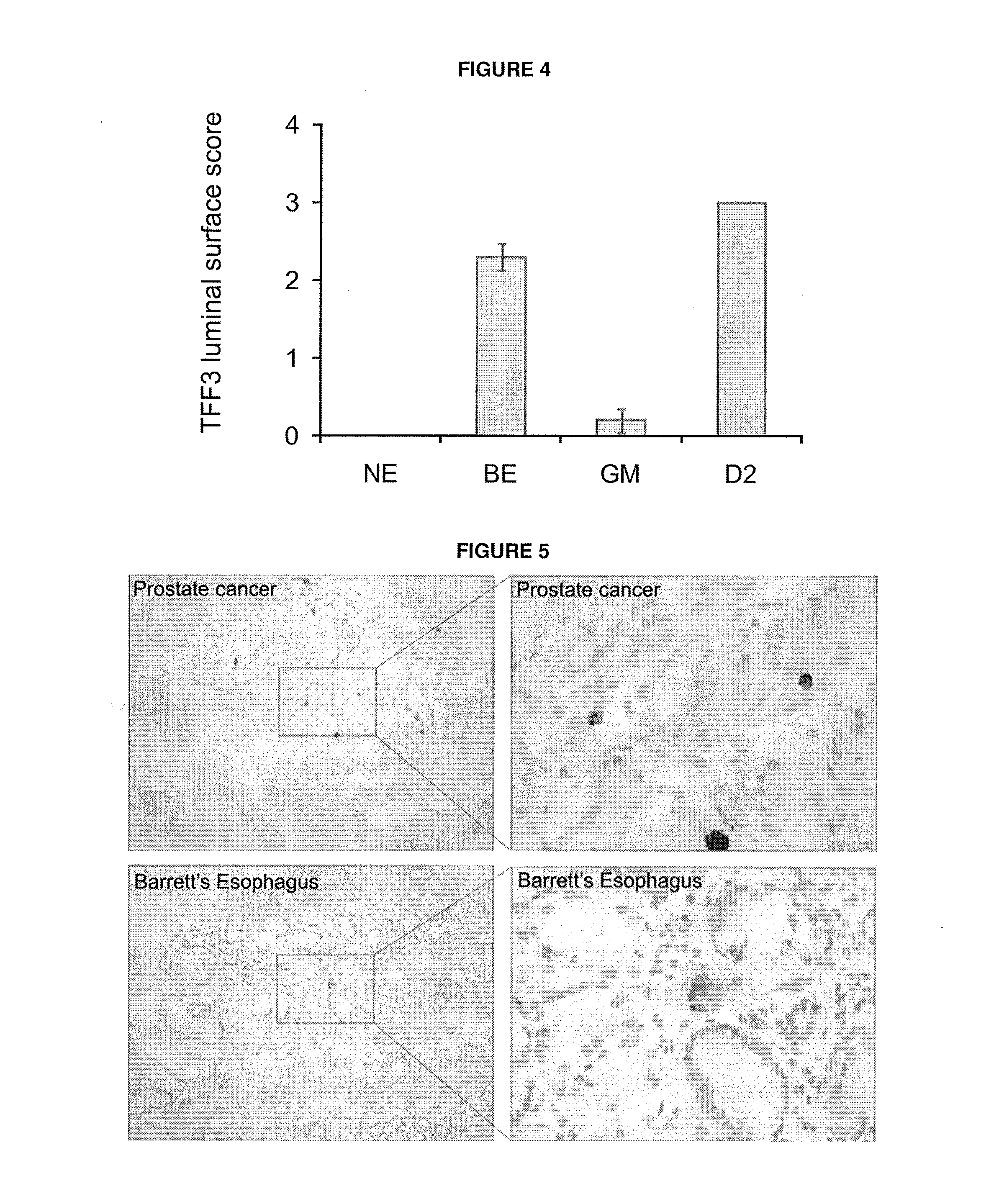 Biomarker for barrett's oesophagus