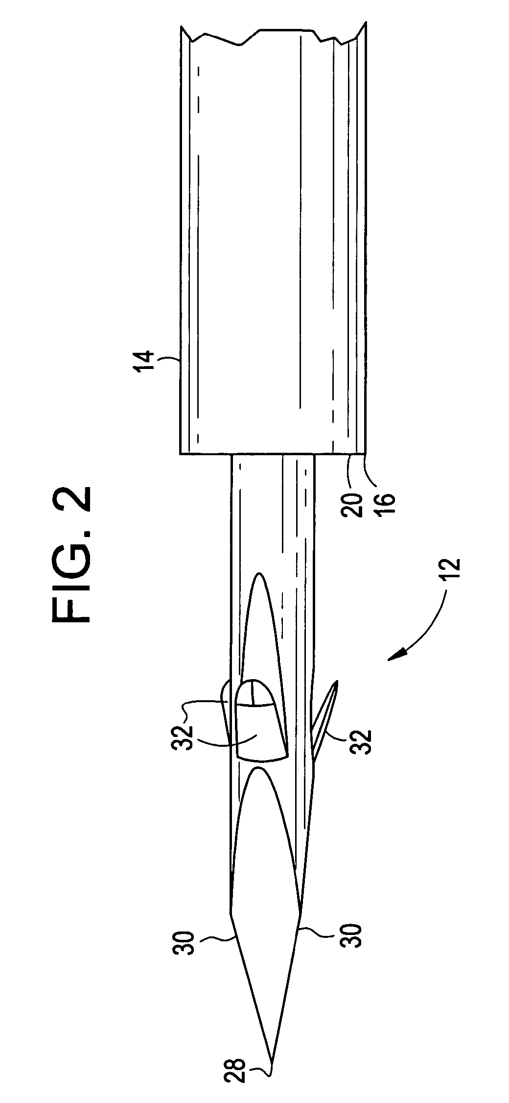 Tissue punch and method for creating an anastomosis for locating a bypass graft