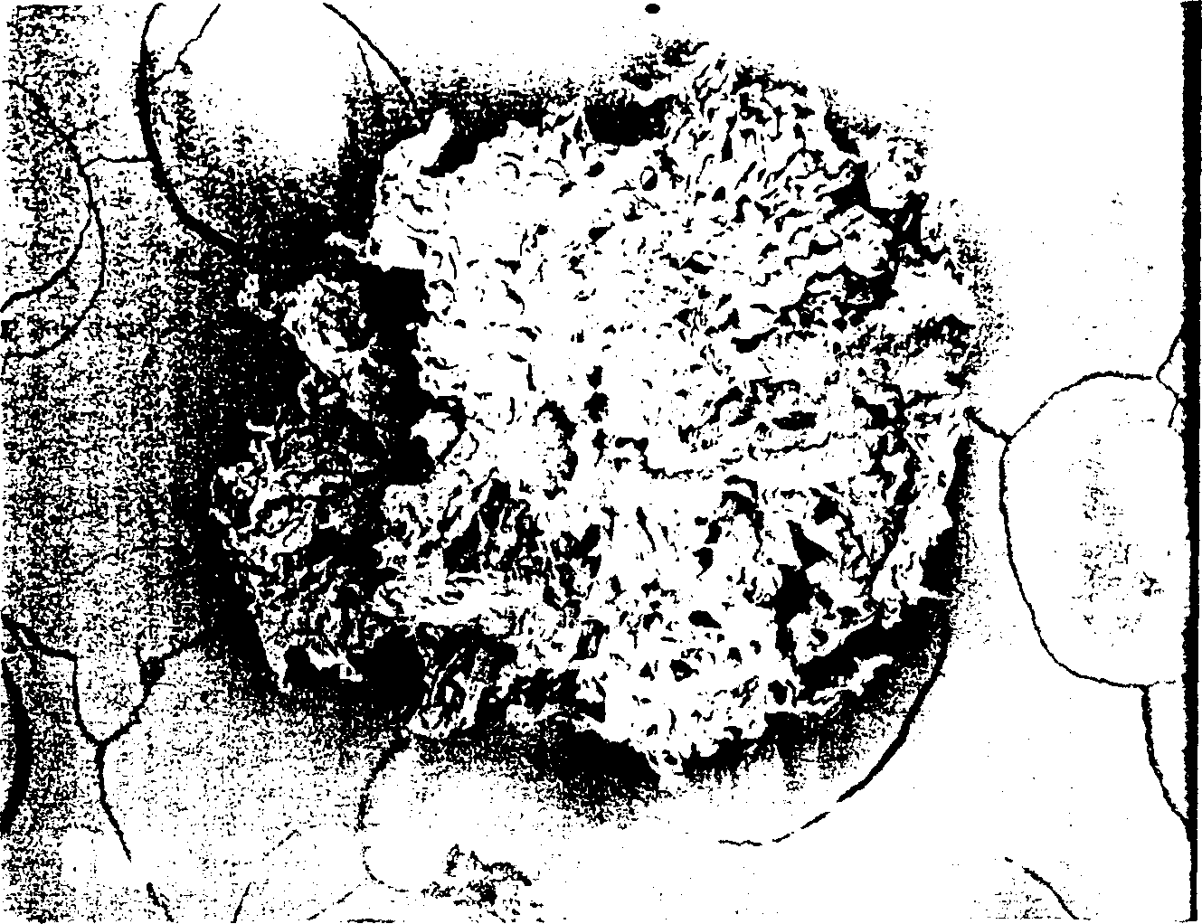 Bioabsorbable polymeric granular porous bone filling material and production method thereof