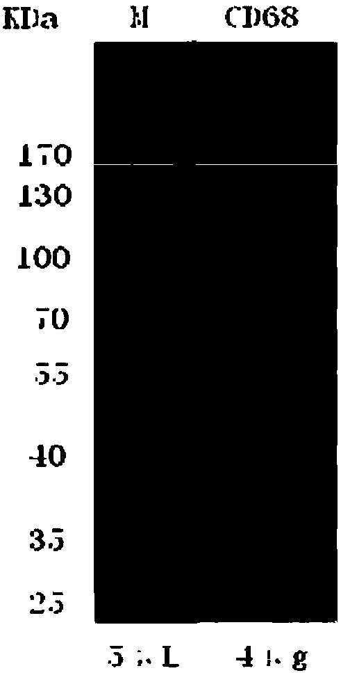 Hybridoma cell strain, CD68 monoclonal antibody, preparation method and application