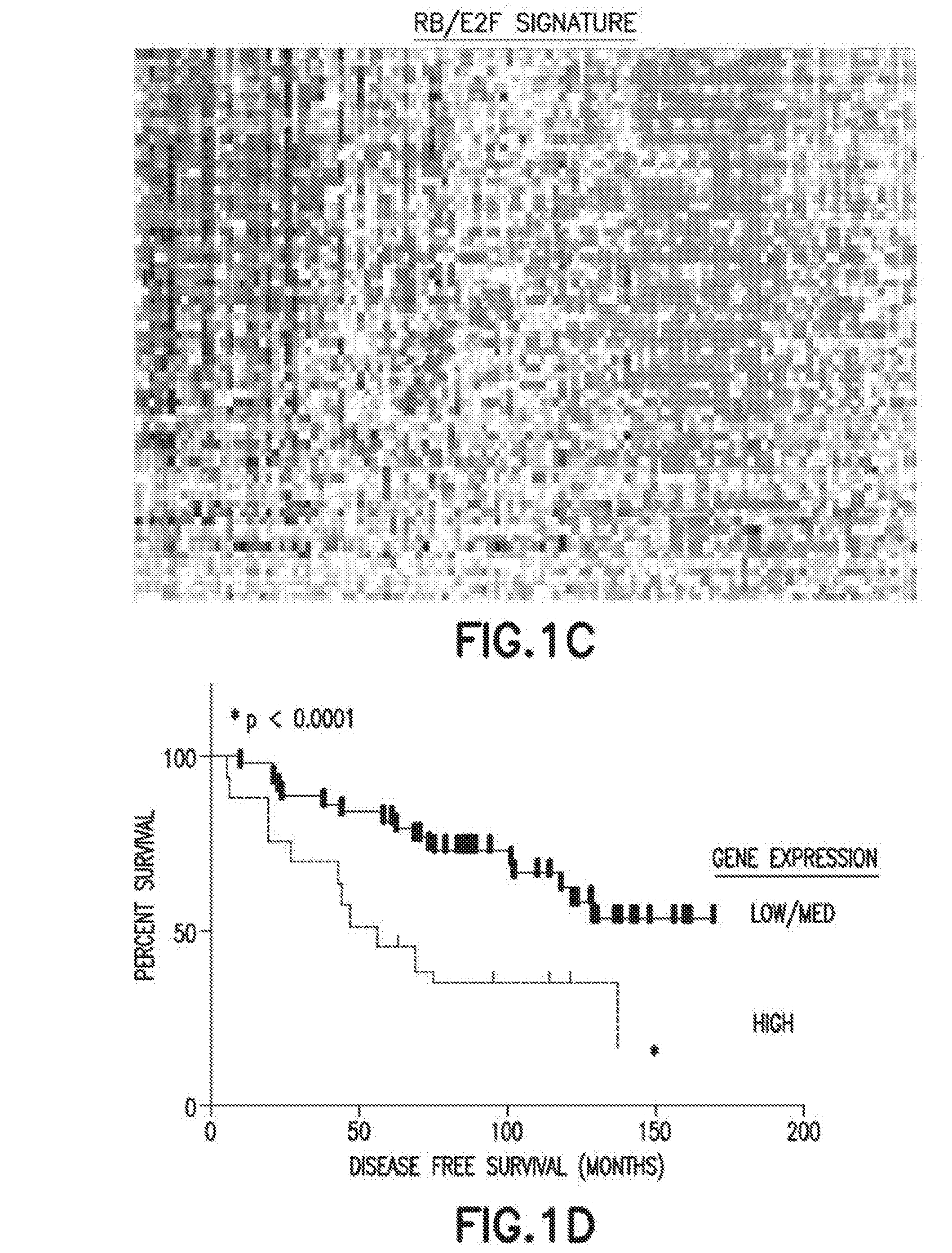 Method of Diagnosis or Prognosis of a Neoplasm Comprising Determining the Level of Expression of a Protein in Stromal Cells Adjacent to the Neoplasm