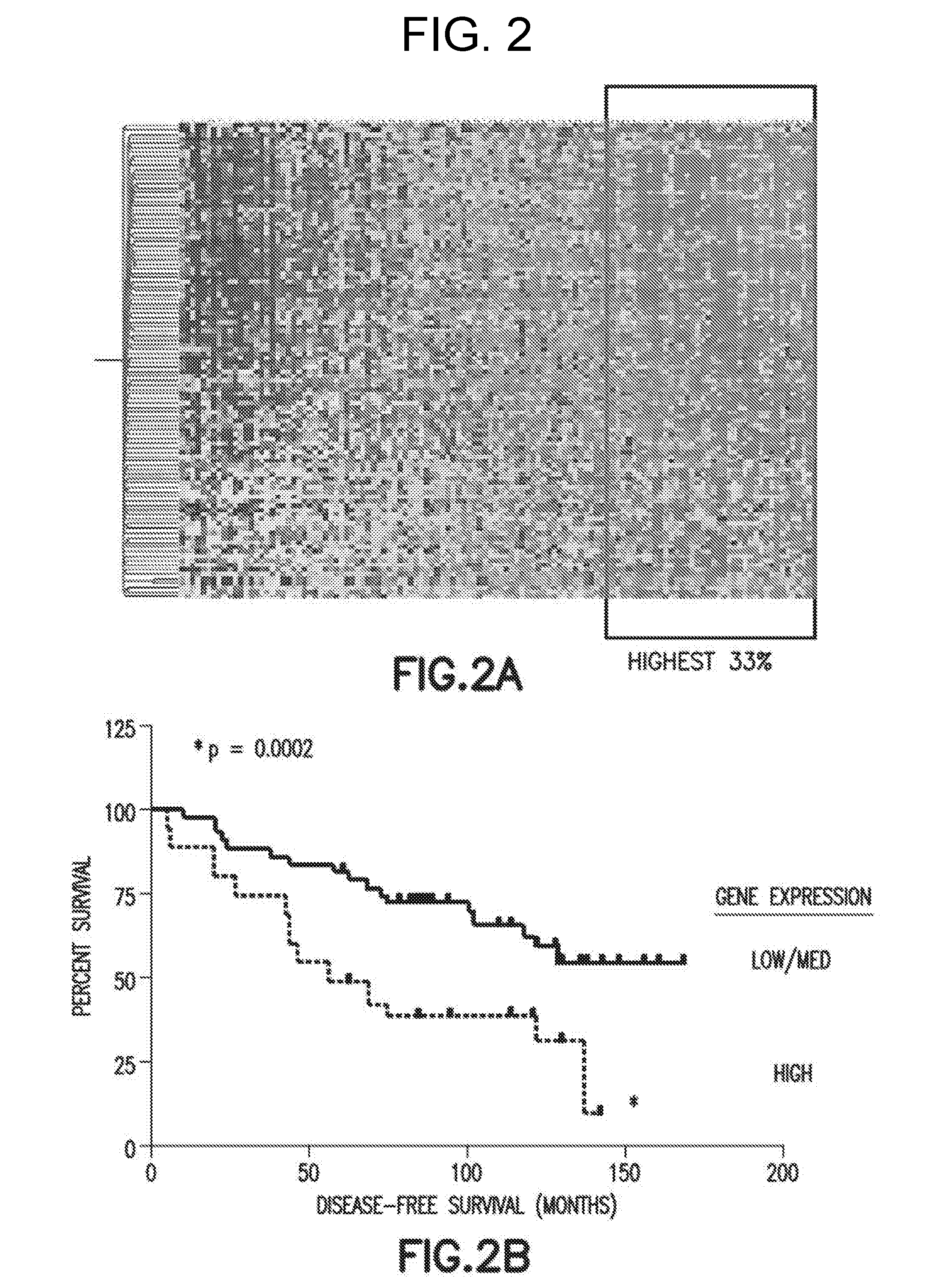 Method of Diagnosis or Prognosis of a Neoplasm Comprising Determining the Level of Expression of a Protein in Stromal Cells Adjacent to the Neoplasm