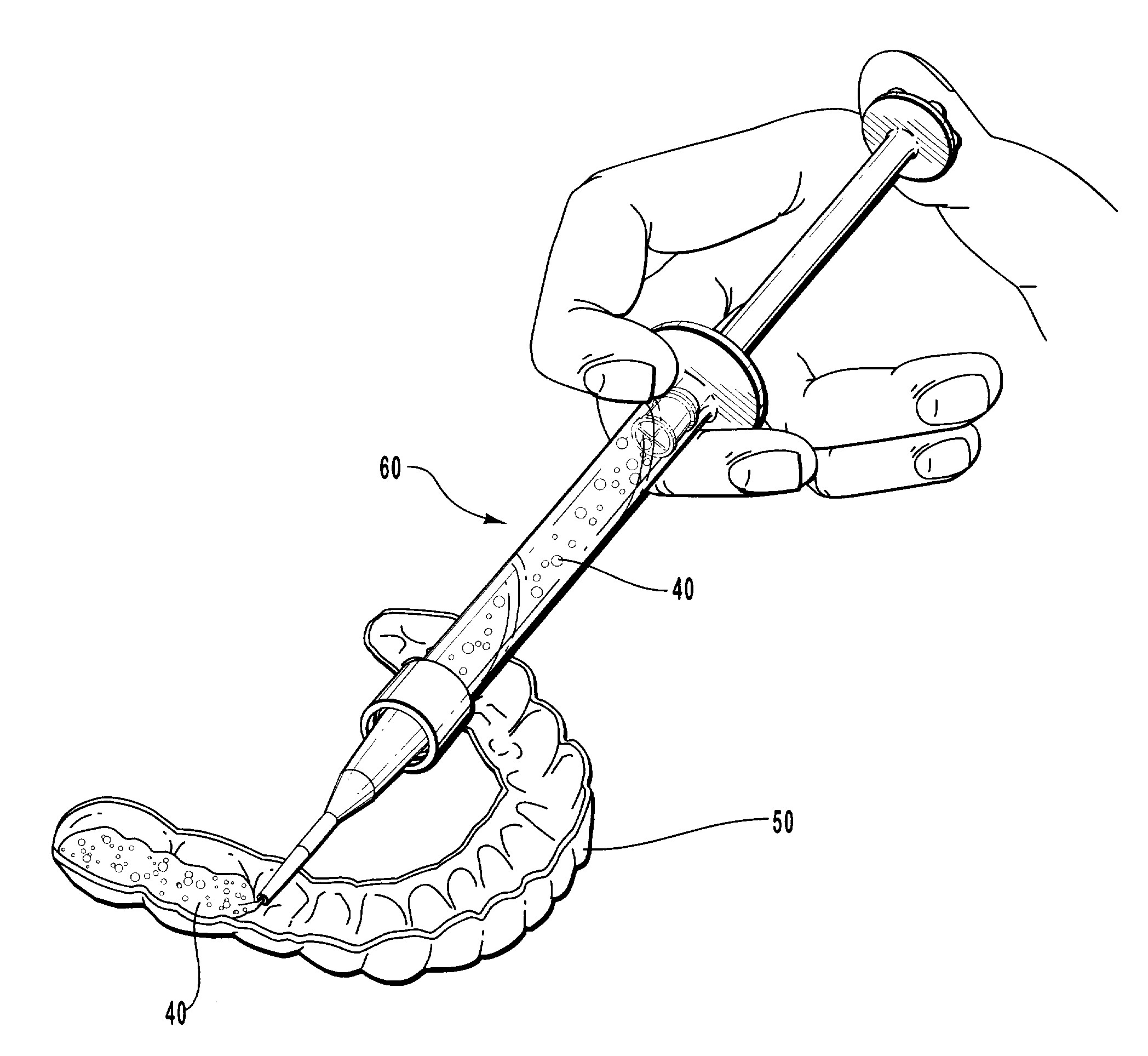 One-part dental compositions and methods for bleaching and desensitizing teeth