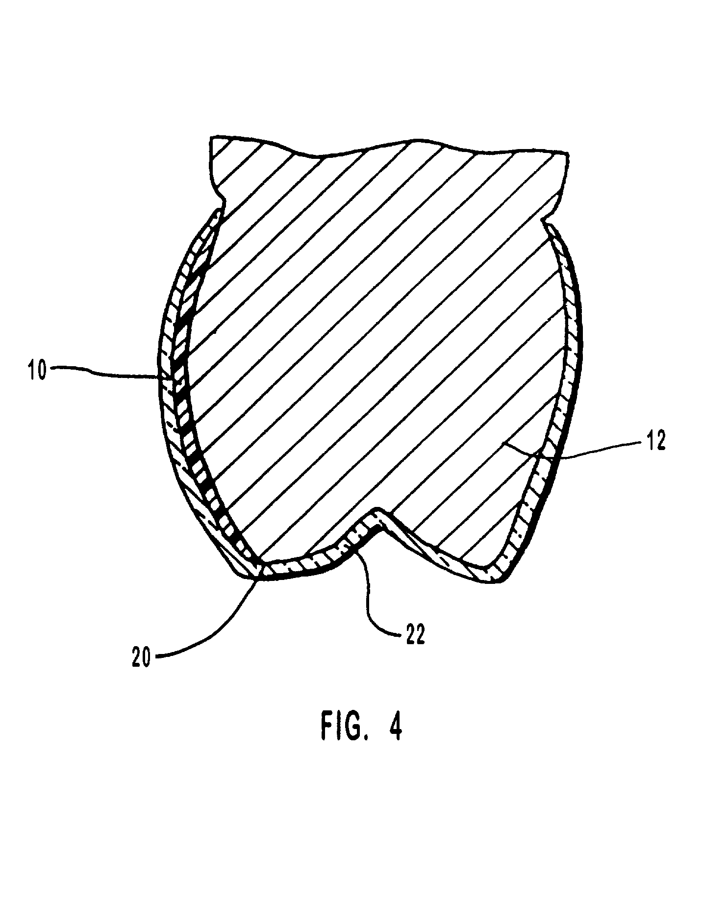 One-part dental compositions and methods for bleaching and desensitizing teeth