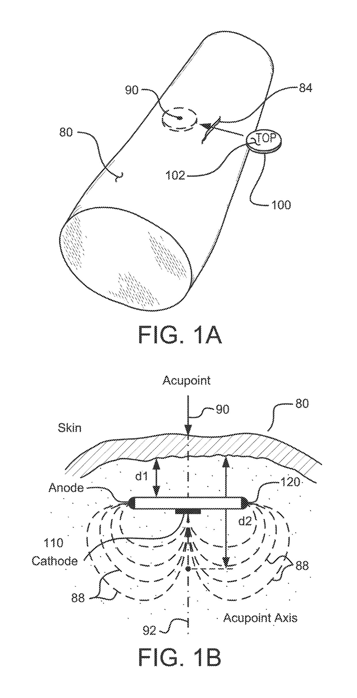 Methods and systems for treating hypertension using an implantable electroacupuncture device