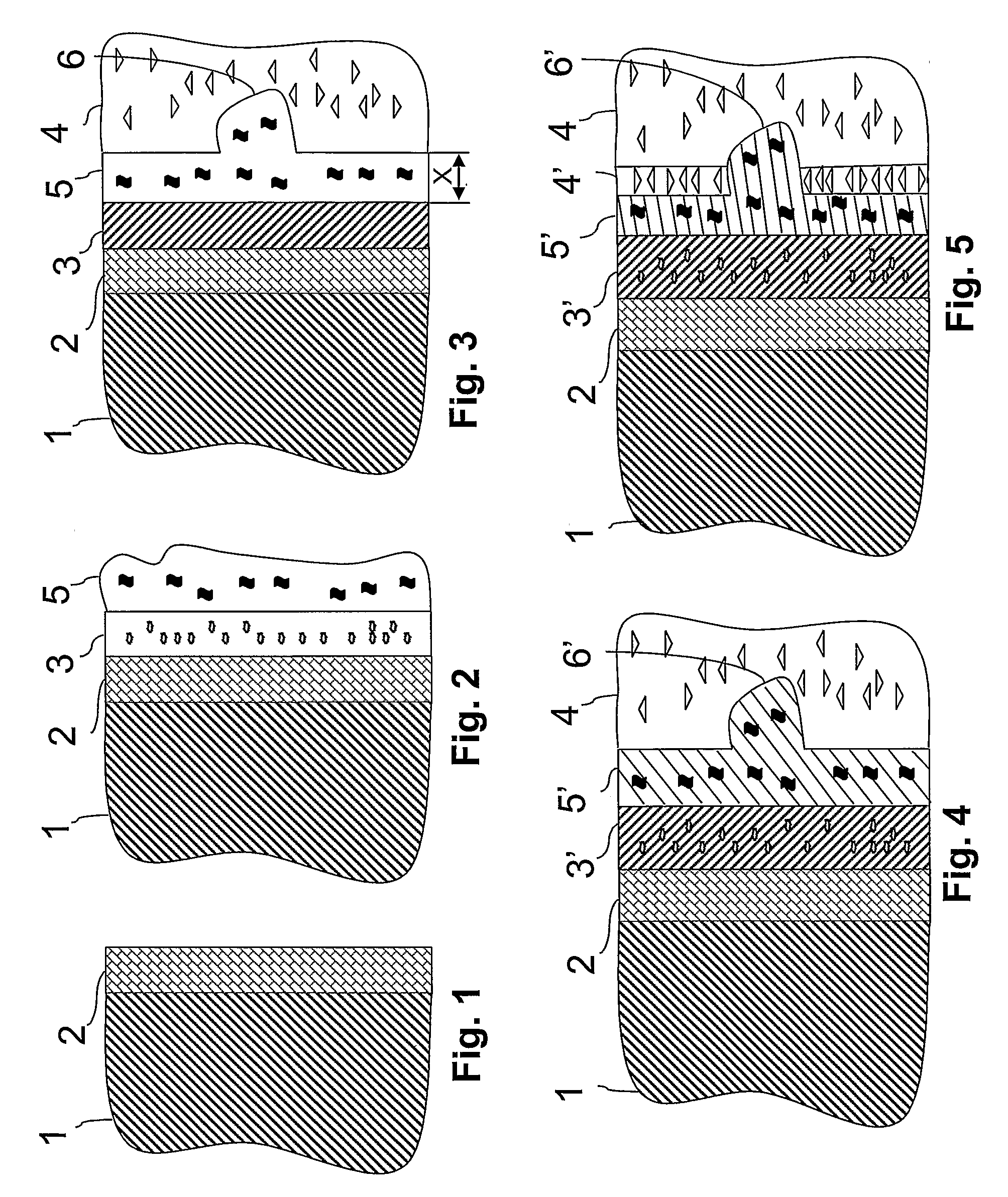 Implant and method of producing the same, and a system for implantation