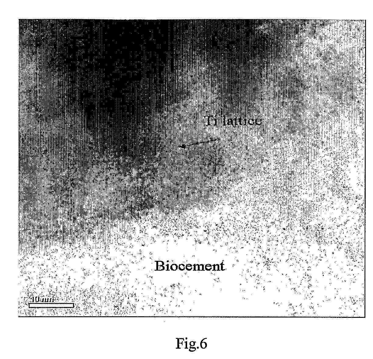 Implant and method of producing the same, and a system for implantation