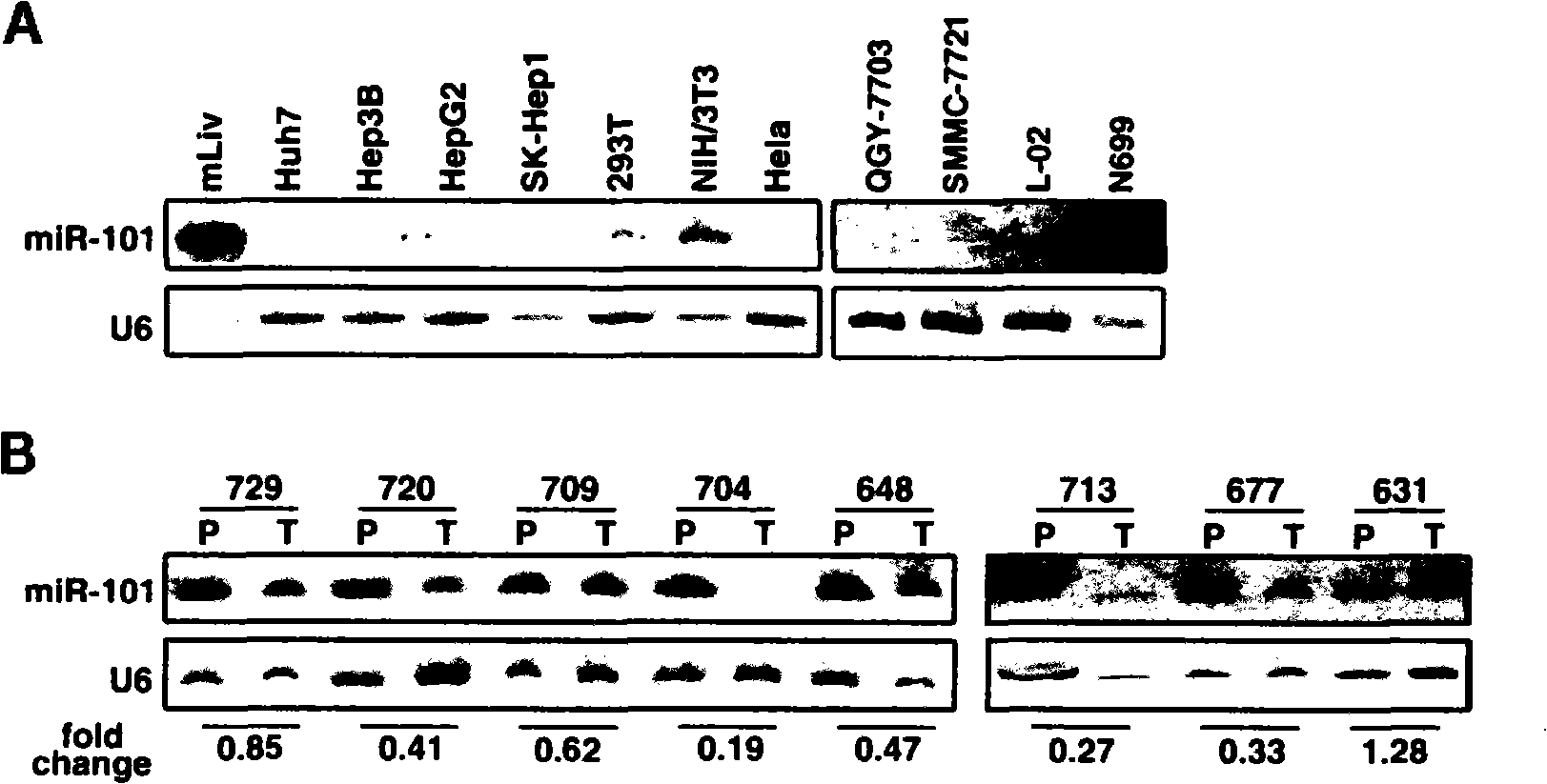 Small molecule noncoding RNA gene hsa-mir-101 and antineoplastic use thereof