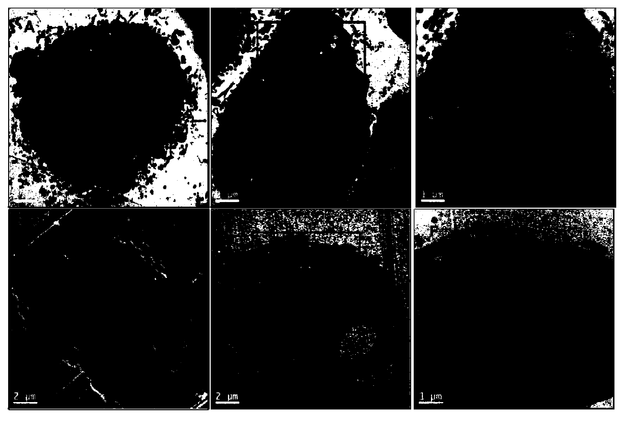 Synergic pharmaceutical composition treating tumors