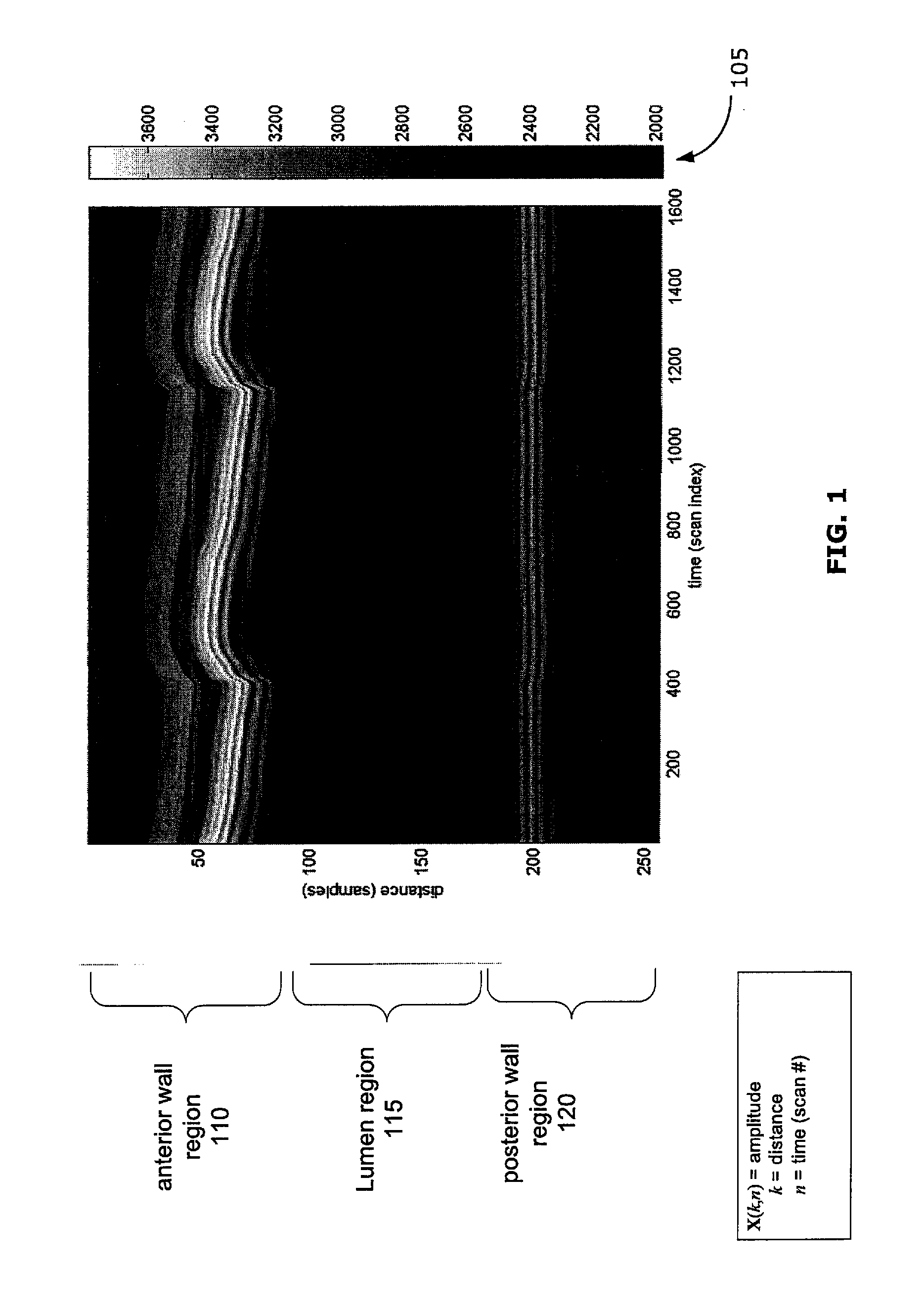 System and method for segmenting m-mode ultrasound images showing blood vessel wall motion over time
