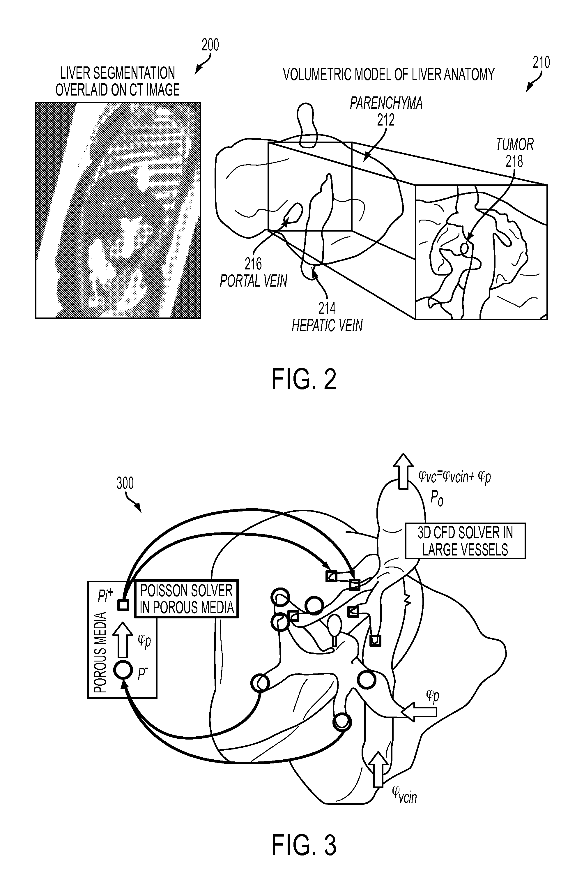 System and Method for Patient Specific Modeling of Liver Tumor Ablation