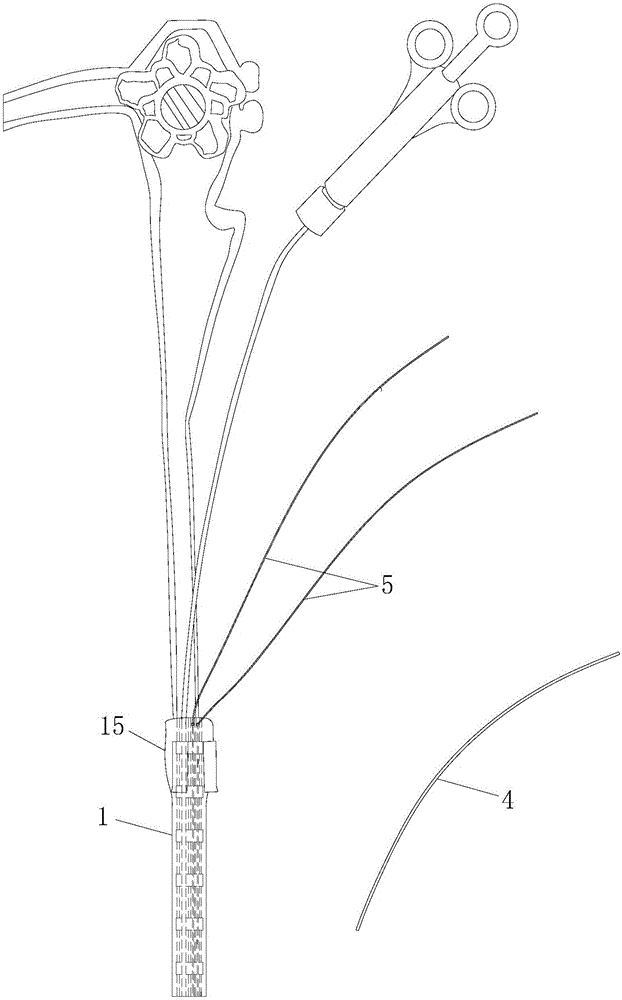 Integral sleeve type endoscopic therapy auxiliary pipeline device