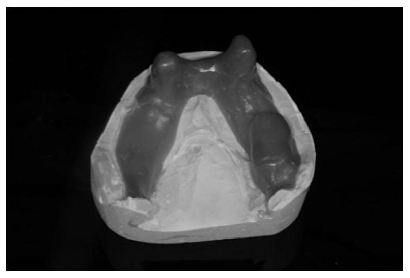 Manufacturing method of improved individual tray capable of preventing isolated abutment tooth from being broken and demolding method thereof