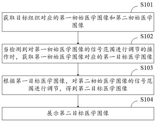 Medical image display method, device, computer equipment and storage medium