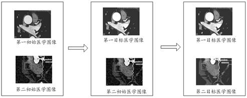 Medical image display method, device, computer equipment and storage medium