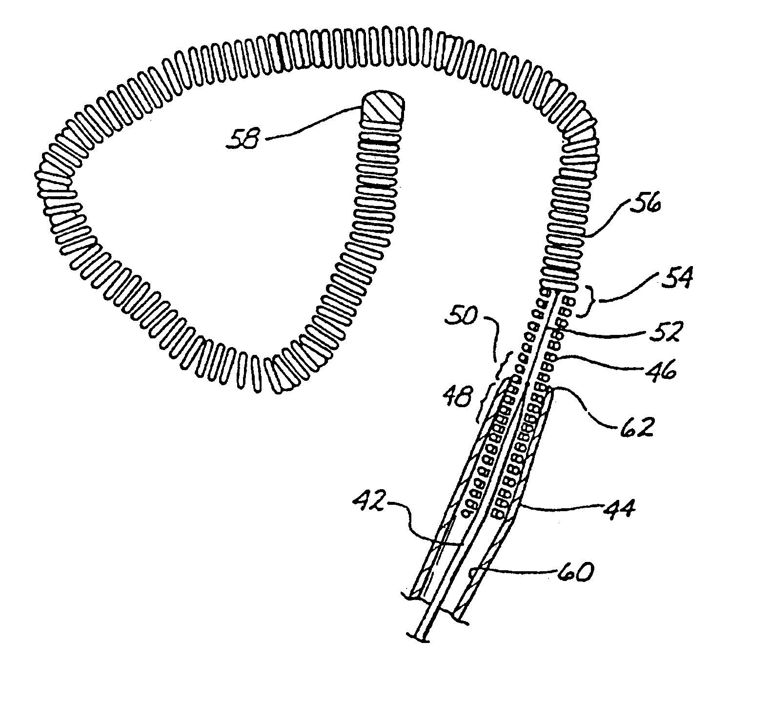 Endovascular electrolytically detachable wire and tip for the formation of thrombus in arteries, veins, aneurysms, vascular malformations and arteriovenous fistulas