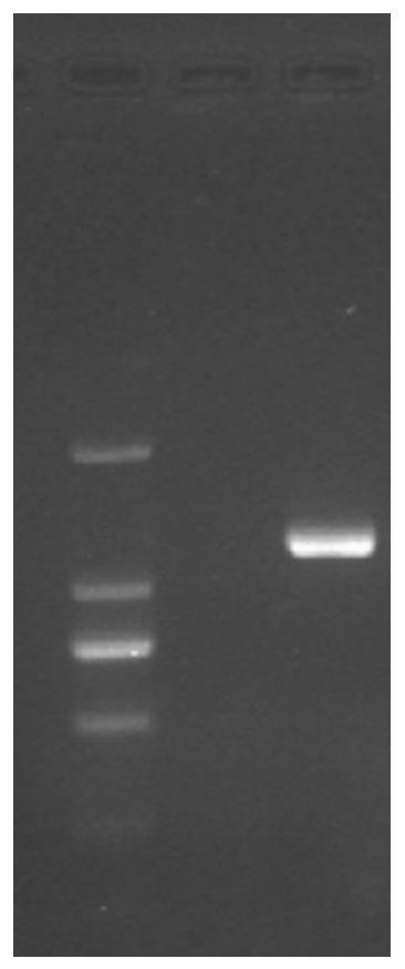 Porcine pseudorabies virus double-gene deletion strain