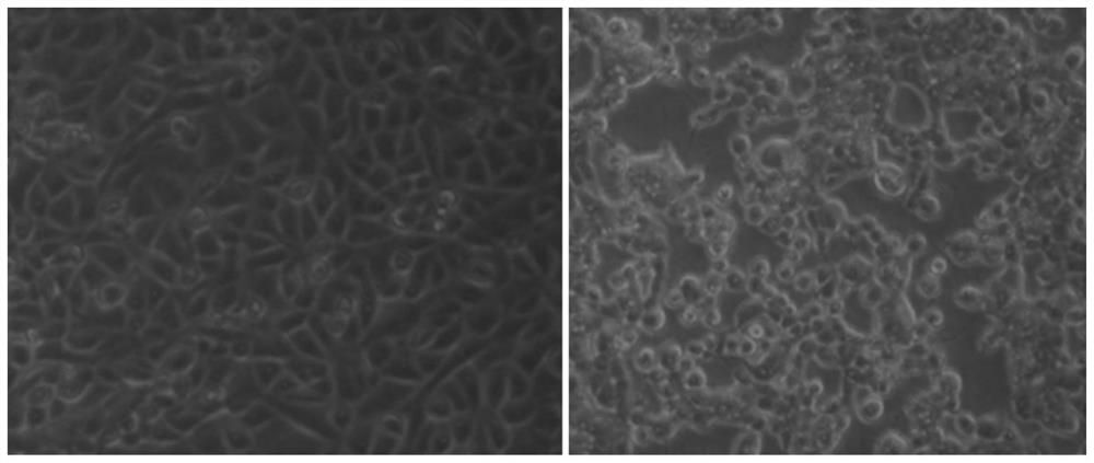 Porcine pseudorabies virus double-gene deletion strain