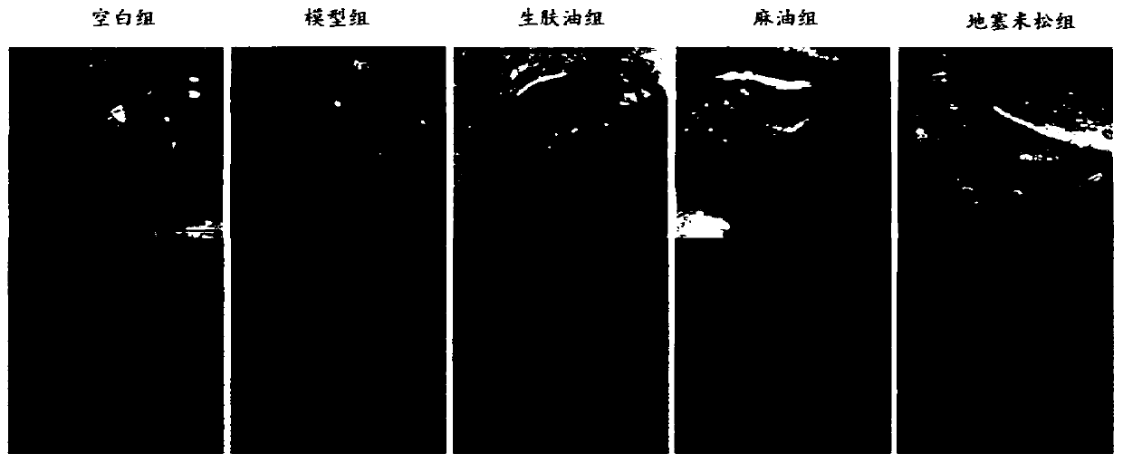Oral skin regeneration promoting oil for treating oral cavity burn and scald and preparation method and application thereof