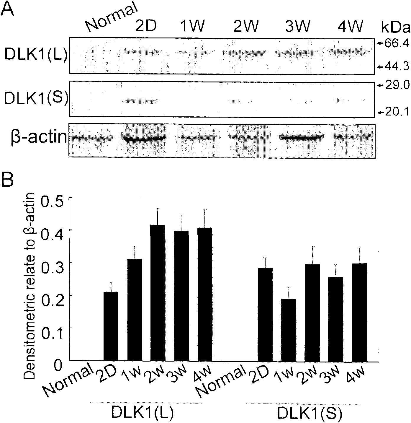 Applications of DLK1 gene, siRNA (small interference Ribonucleic Acid), BM-MSCs (Bone Marrow Mesenchymal Stem Cells) and FGF2 (Fibroblast Growth Factor2)