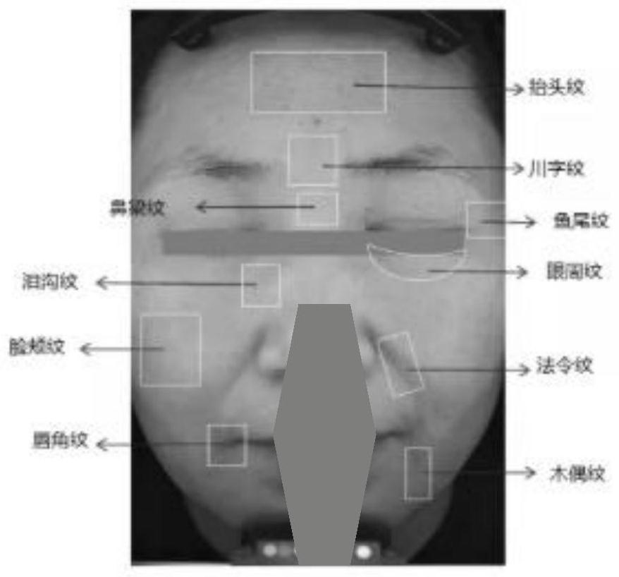 Cosmetic composition with anti-wrinkle and tightening effects and application thereof