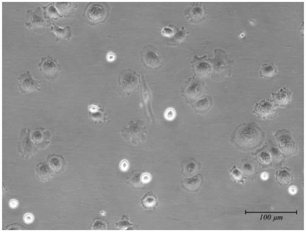 Method for constructing in-vitro culture and damage model of pelodiscus sinensis embryonic period skirt fibroblasts