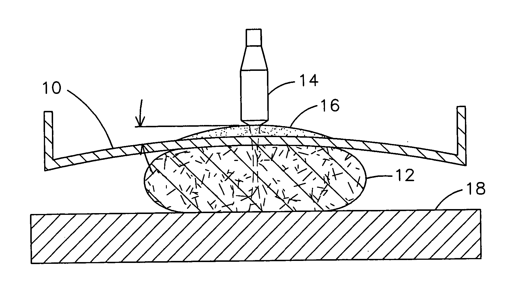 Compression paddle membrane and tensioning apparatus for compressing tissue for medical imaging purposes