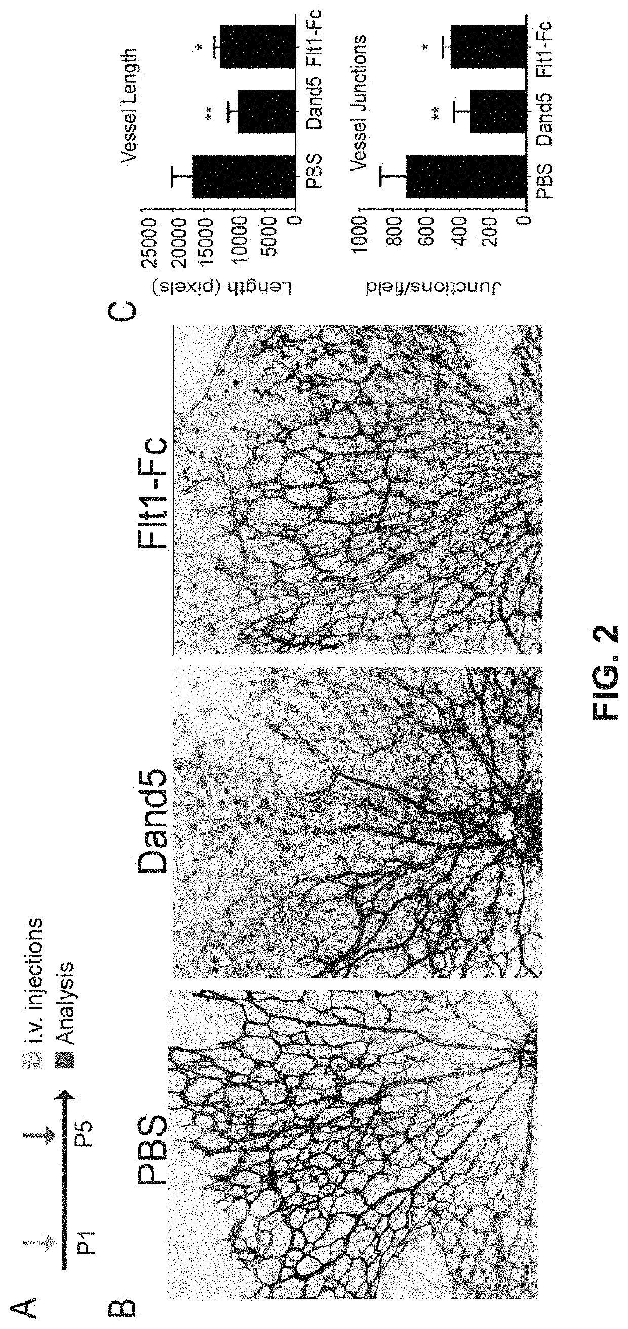 Uses of dan family bmp antagonists for inhibiting ocular neovascularization and treating ocular conditions