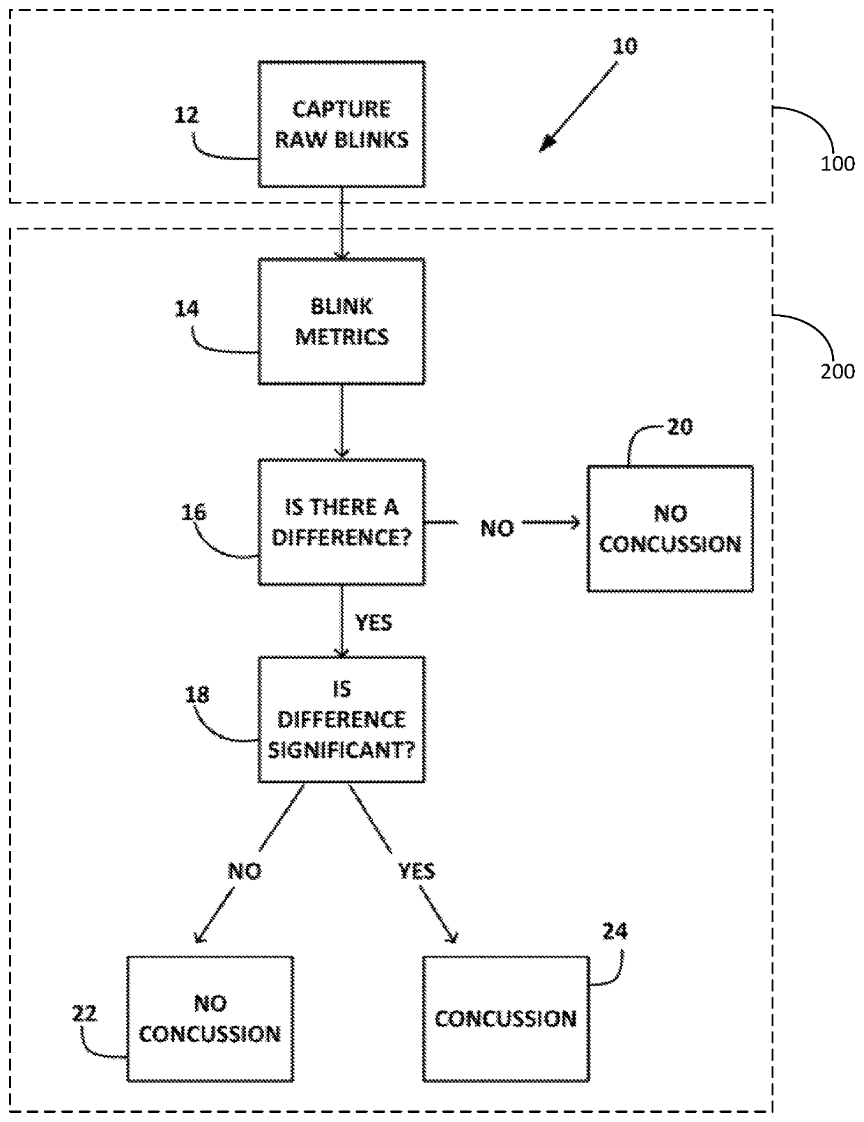 Method and system for detecting concussion