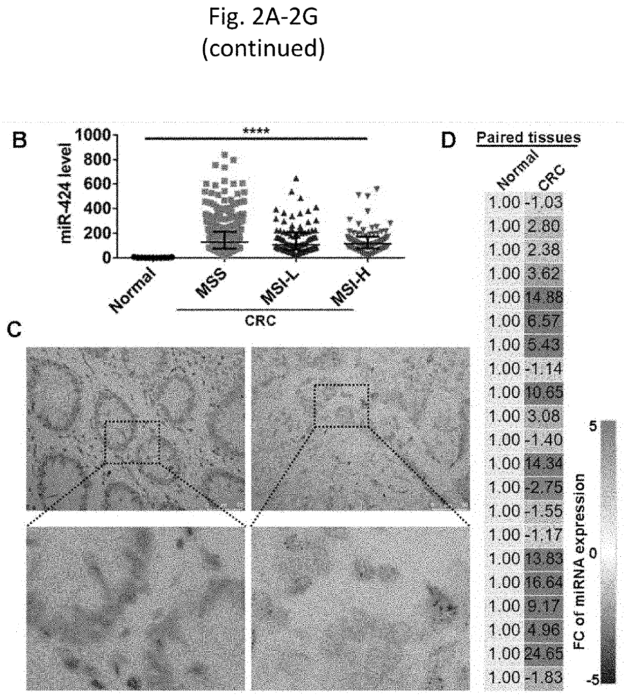 Tumor cell-derived exosomes and method of treating colorectal cancer