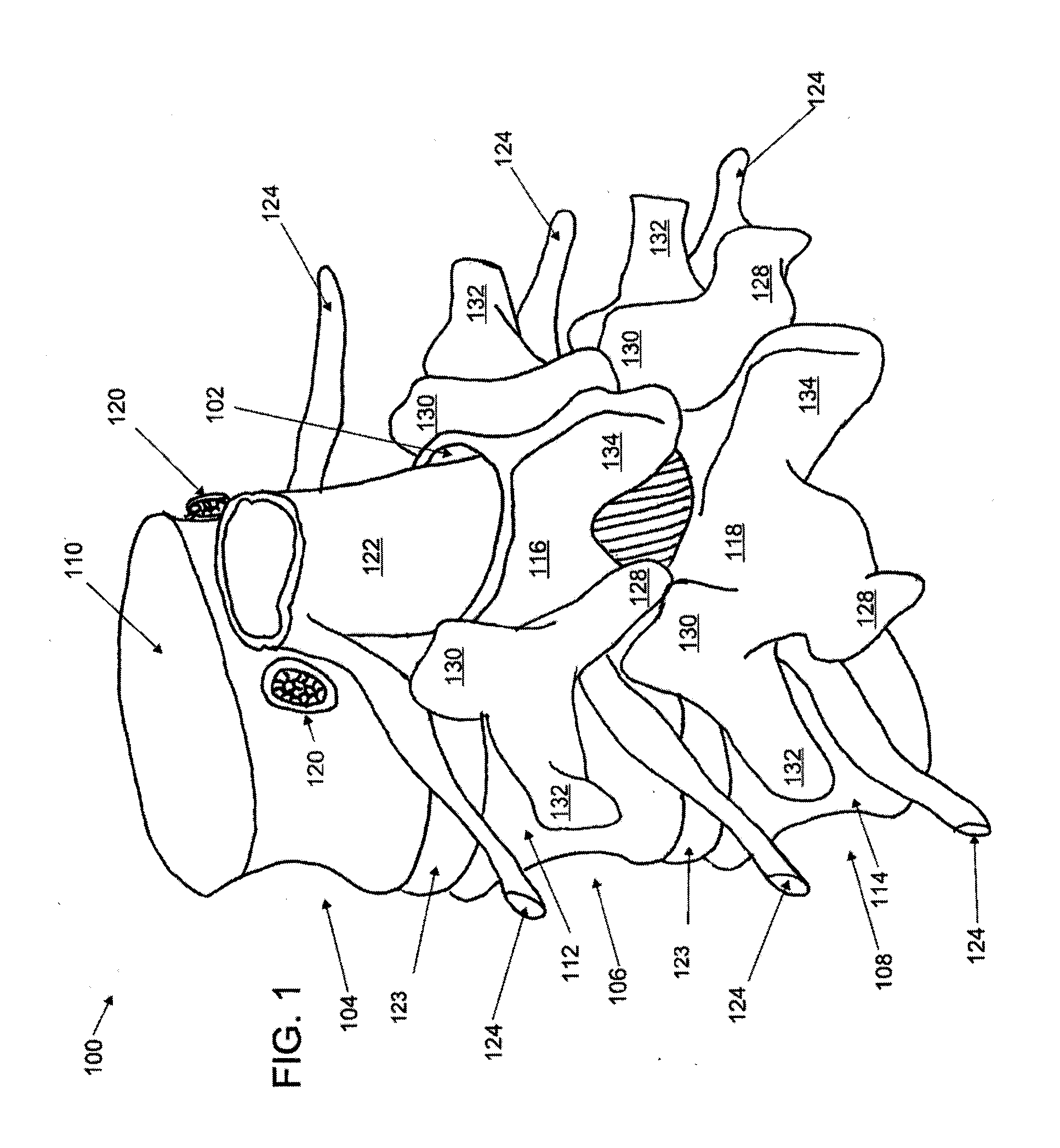 Articulating tissue removal systems and methods