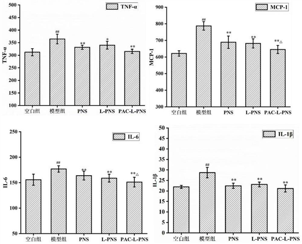 Panax notoginseng total saponin myocardial targeting liposome and preparation method thereof