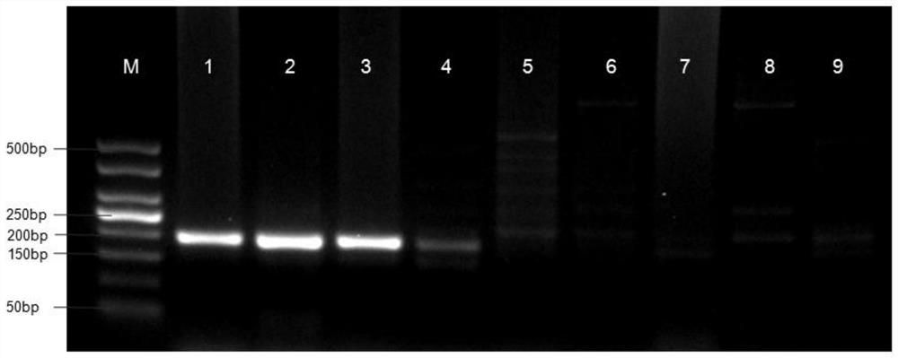 Liver echinococcus gene segment screening method, amplification primer and kit