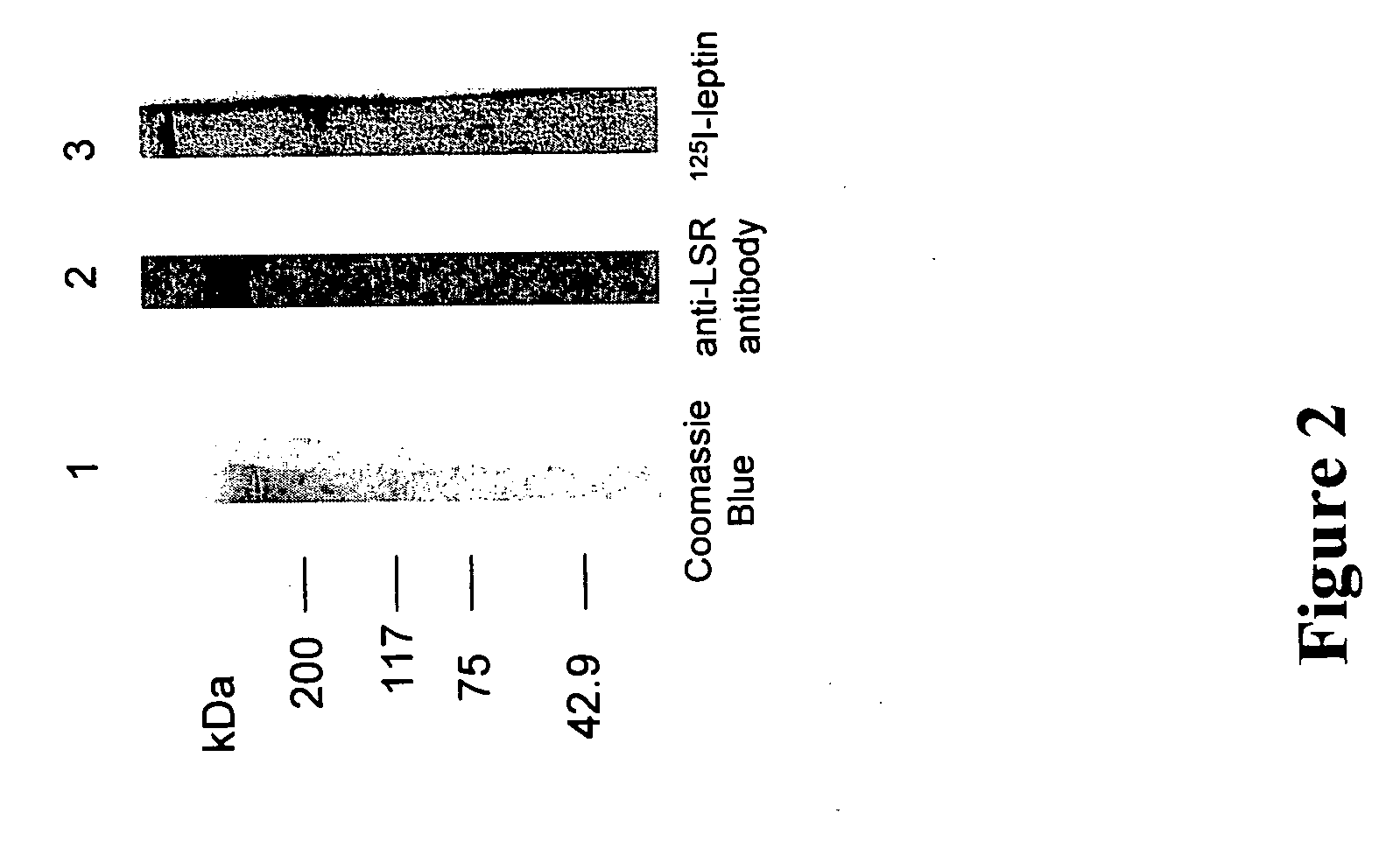 Methods of screening for compounds that modulate the LSR-leptin interaction and their use in the prevention and treatment of obesity-related diseases