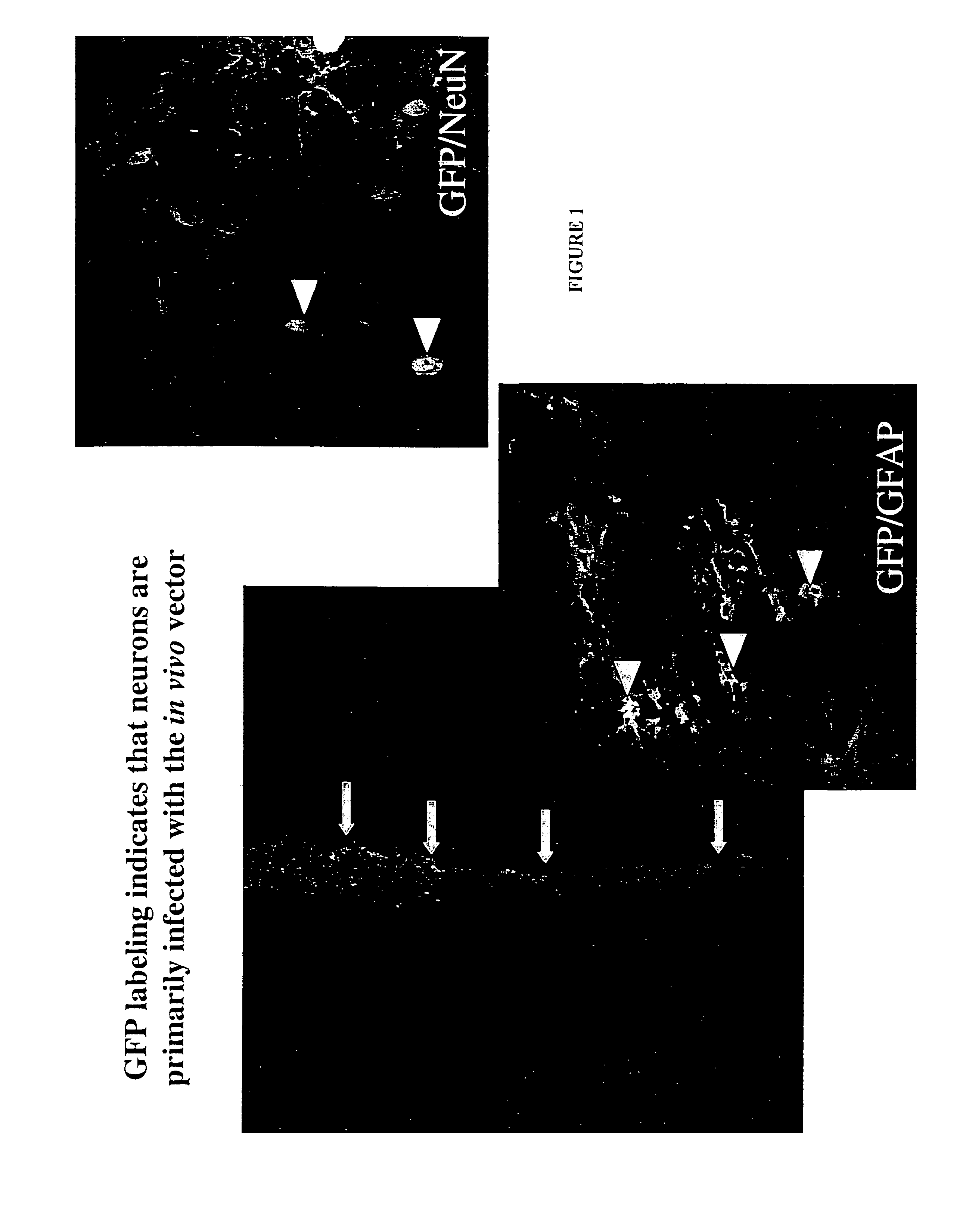 Methods for therapy of neurodegenerative disease of the brain