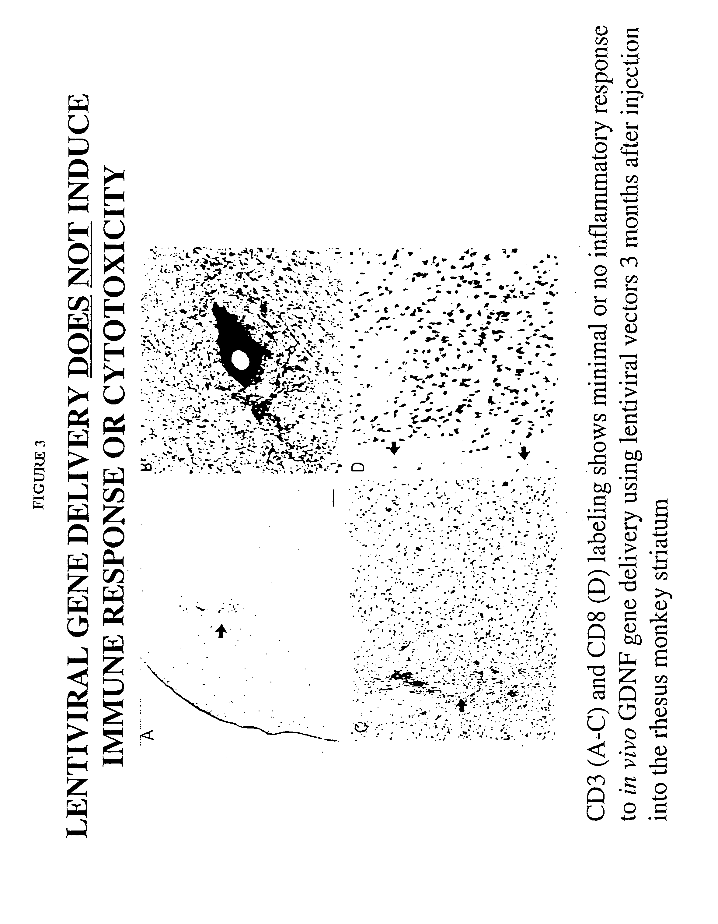 Methods for therapy of neurodegenerative disease of the brain