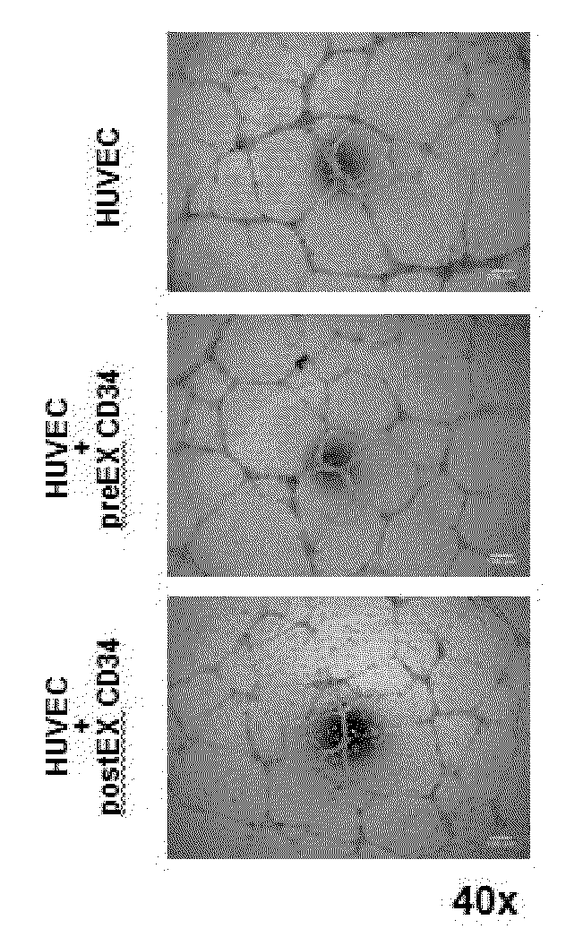 Method For Amplification And Functional Enhancment Of Blood Derived Progenitor Cells Using A Closed Culture System