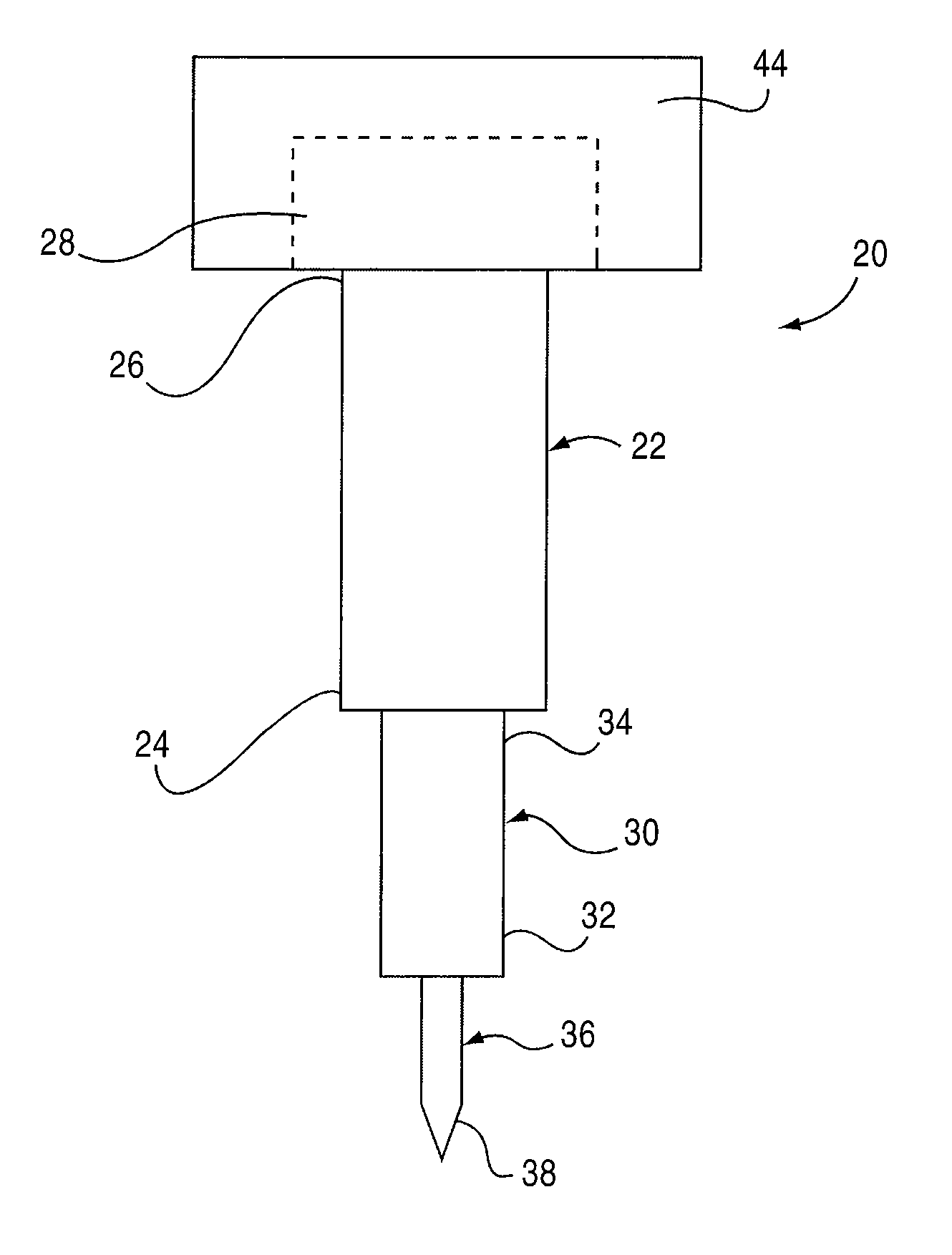 Retractable cannula and method for minimally invasive medical procedure