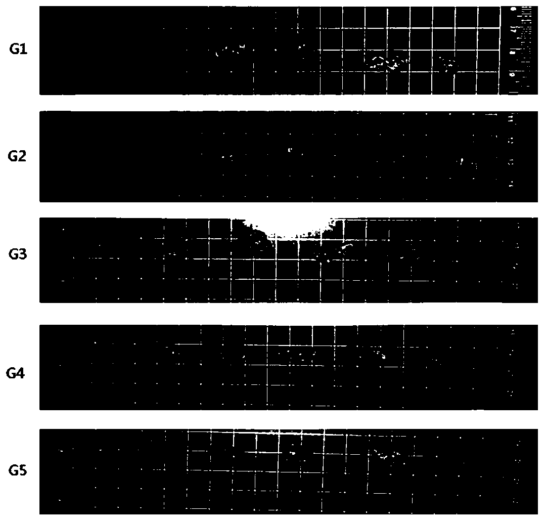 Metabolites related to acute pancreatitis and their application