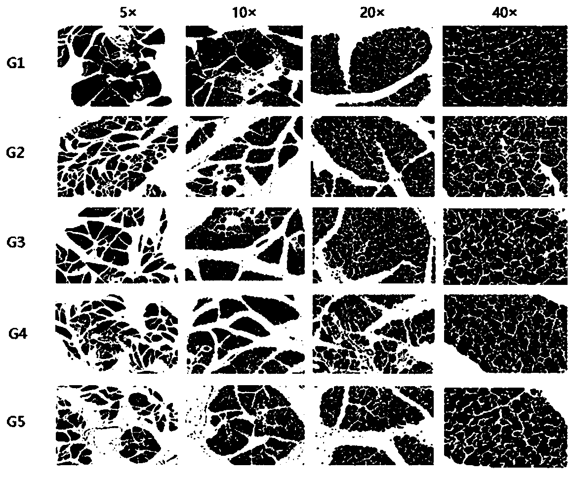 Metabolites related to acute pancreatitis and their application