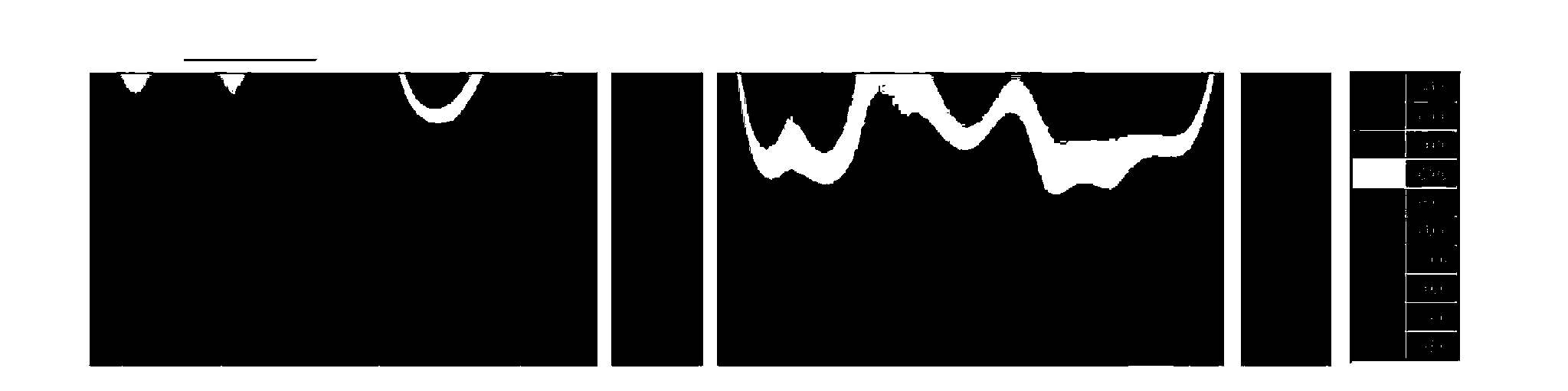 Crystallizer bleed-out visual forecasting method based on machine vision